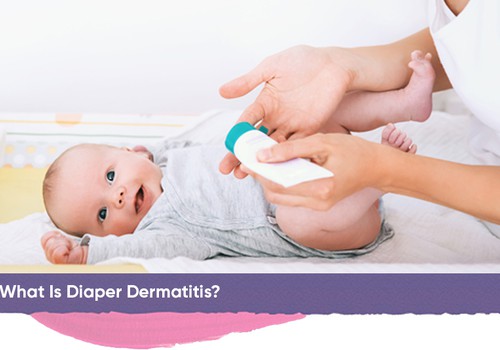 Tėvų žinios apie vystyklų dermatitą
