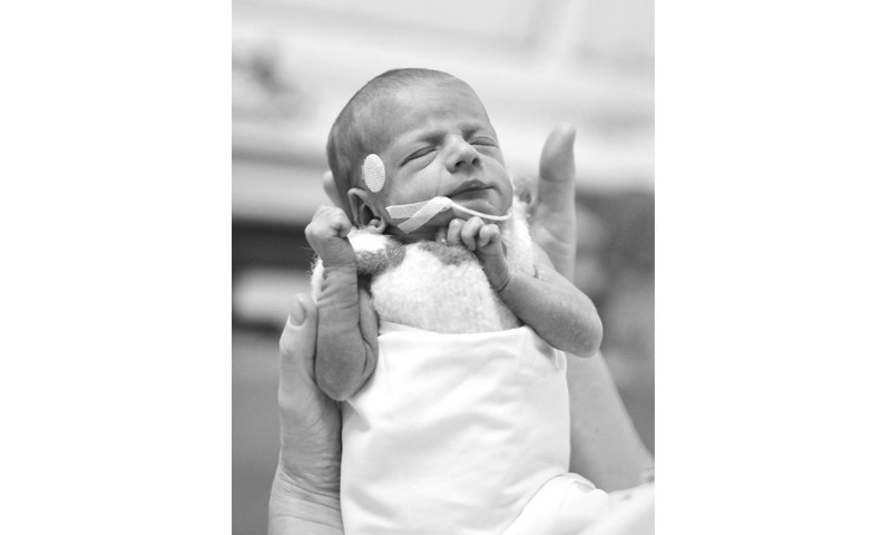 „Ankstukų“ dovanota medicininė įranga prisideda prie tausojančio mažiausių kūdikių gydymo